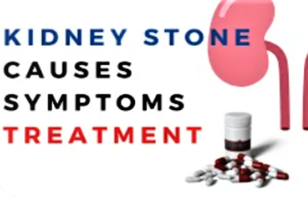 Kidney stones signs,treatment and advice