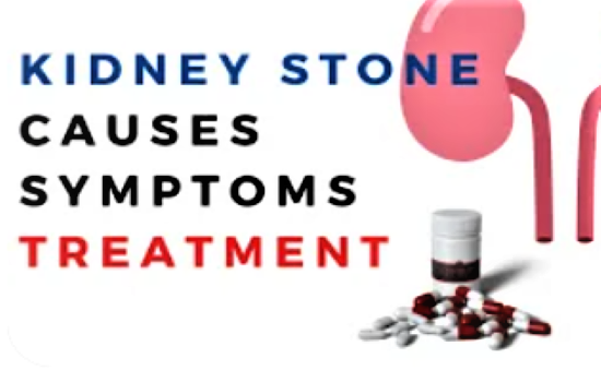 Kidney stones signs,treatment and advice