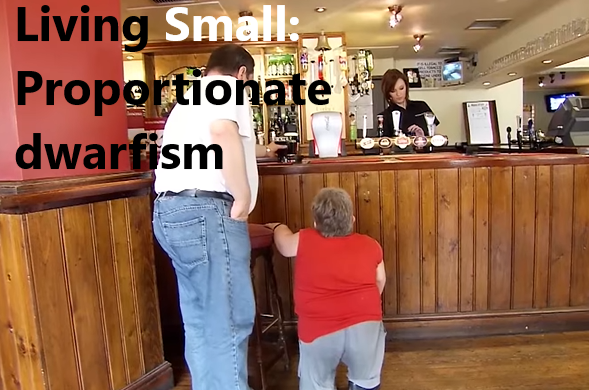 Proportionate Dwarfism: Symptoms, Causes and Treatment